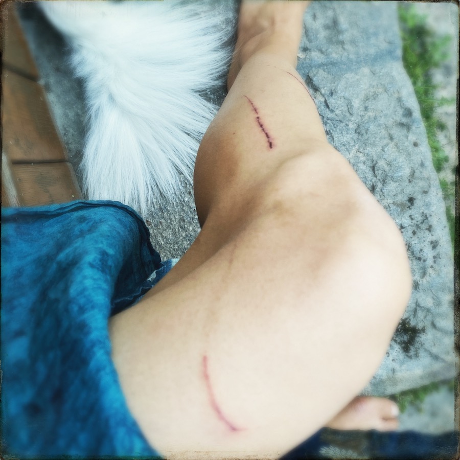 scratched by a cat